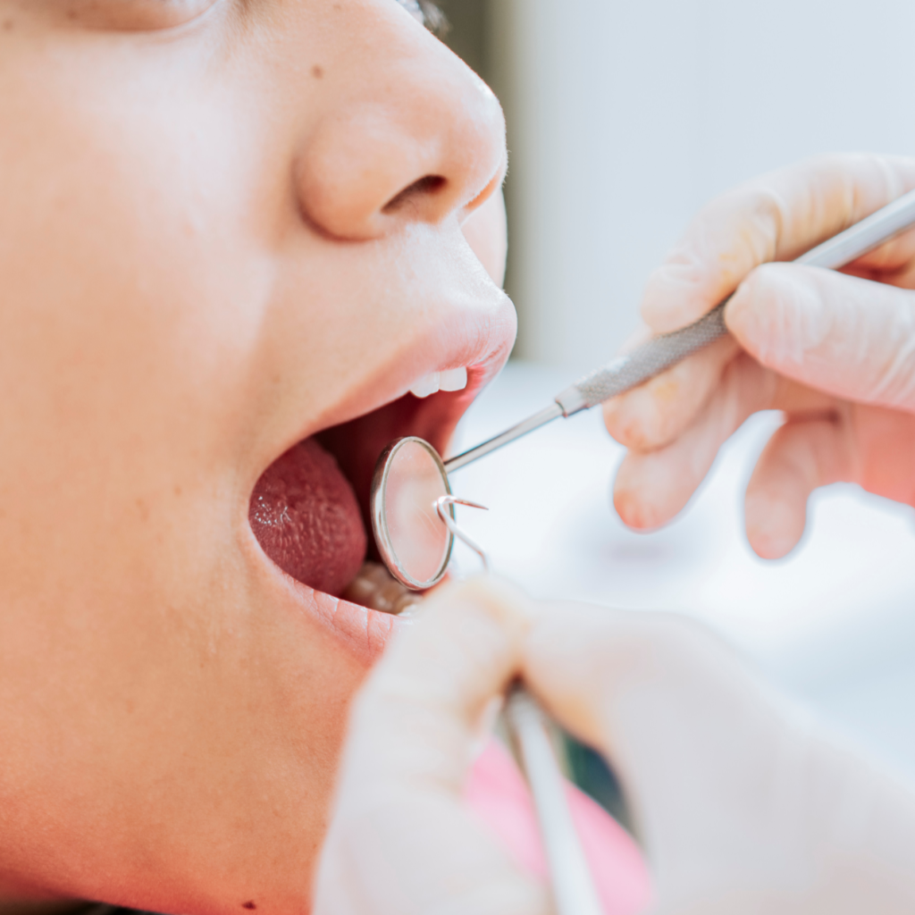 Cuidados Pós-Tratamento em Endodontia: Um Guia Completo
